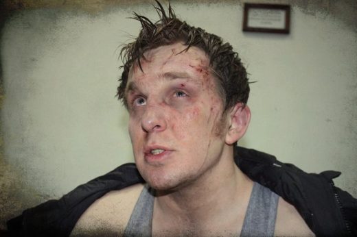 Vitaliy Dudin beaten